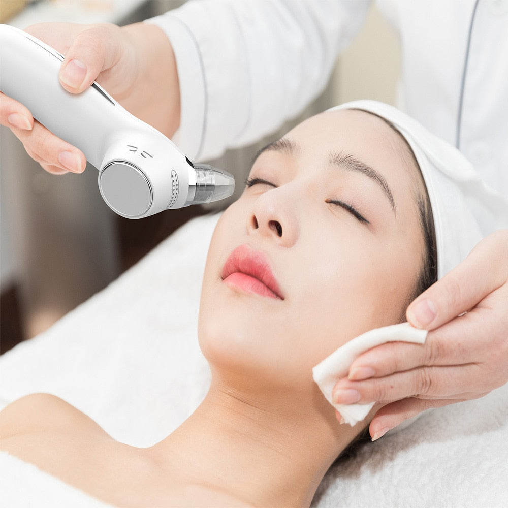 Professional Blackhead Remover Vacuum Acne Pimple Black Spot Suction